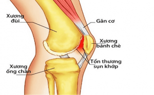 unnamed (4) may-dieu-tri-khop-goi