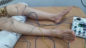 Châm cứu điện chữa đau khớp gối - Quy trình và những lưu ý