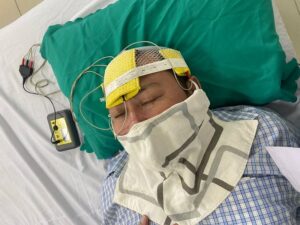 Kich-thich-dien-xuyen-so-hdcstim-3 Kich-thich-dien-xuyen-so-hdcstim-3