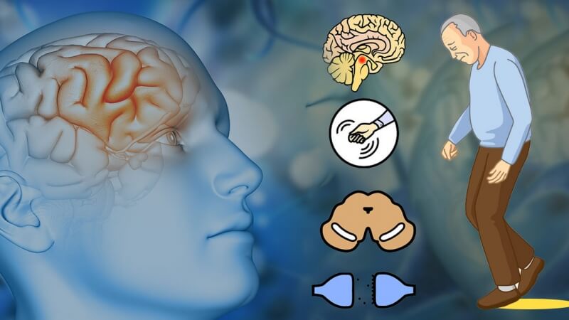 benh parkinson - C&aacute;c d&ograve;ng thiết bị tập phục hồi chức năng cho người bệnh Parkinson