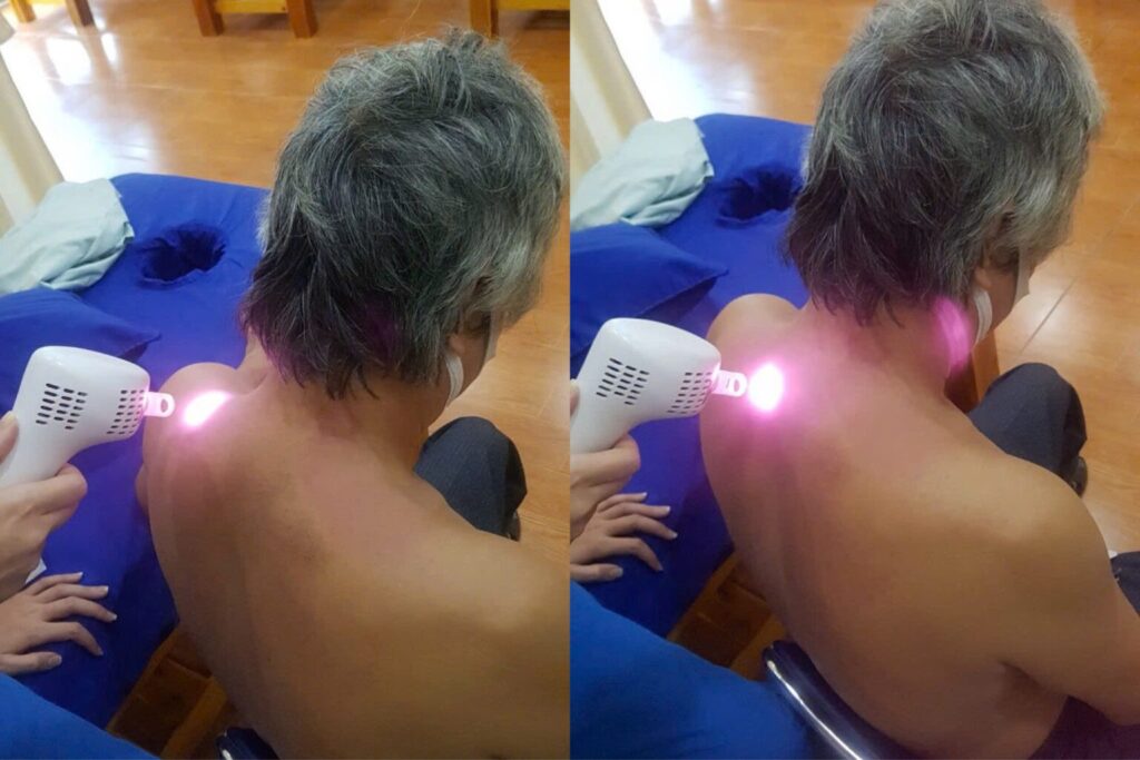 laser cong suat cao 2 1024x683 - So s&aacute;nh Laser Trị Liệu C&ocirc;ng Suất Thấp v&agrave; C&ocirc;ng Suất Cao