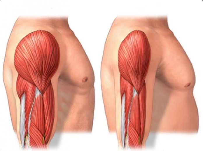 Điều trị teo cơ bằng vật lý trị liệu - Thiết bị y tế Hải Minh
