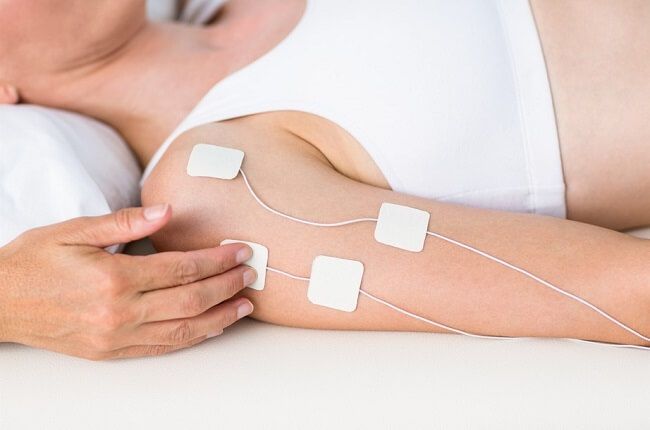 kich thich dien chuc nang - Kích thích điện chức năng (FES): Ứng dụng và Kỹ thuật