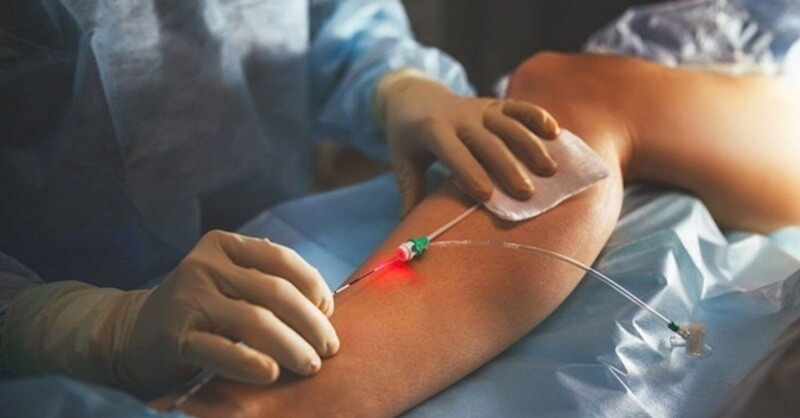 ung dung va ky thuat dieu tri laser noi mach cong suat thap 1 - Ứng dụng và kỹ thuật điều trị laser nội mạch công suất thấp