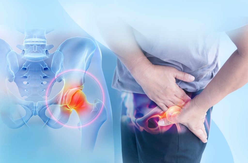 thoai hoa khop hang 1024x673 - Tho&aacute;i h&oacute;a khớp h&aacute;ng l&agrave; g&igrave; v&agrave; c&aacute;ch điều trị tho&aacute;i h&oacute;a khớp h&aacute;ng