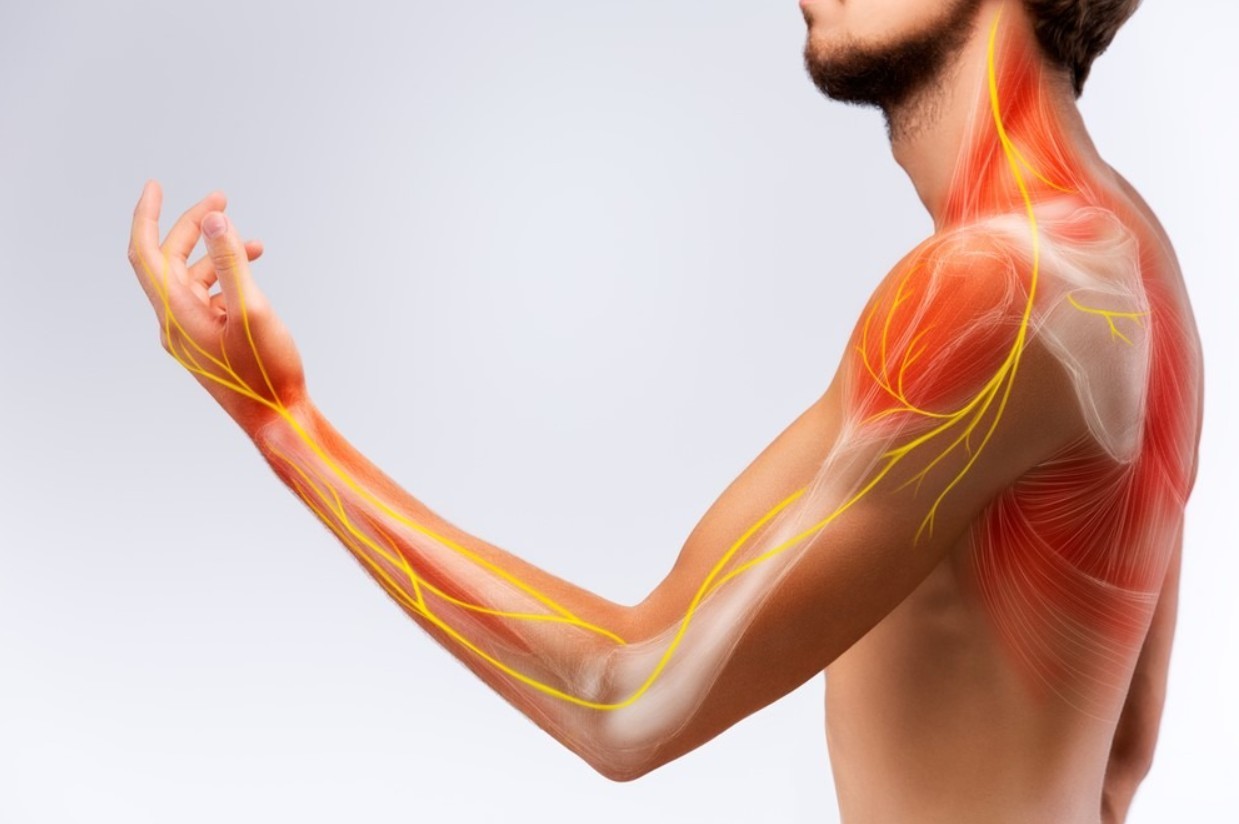 benh viem da day than kinh - Điều trị bệnh vi&ecirc;m đa d&acirc;y thần kinh vận động