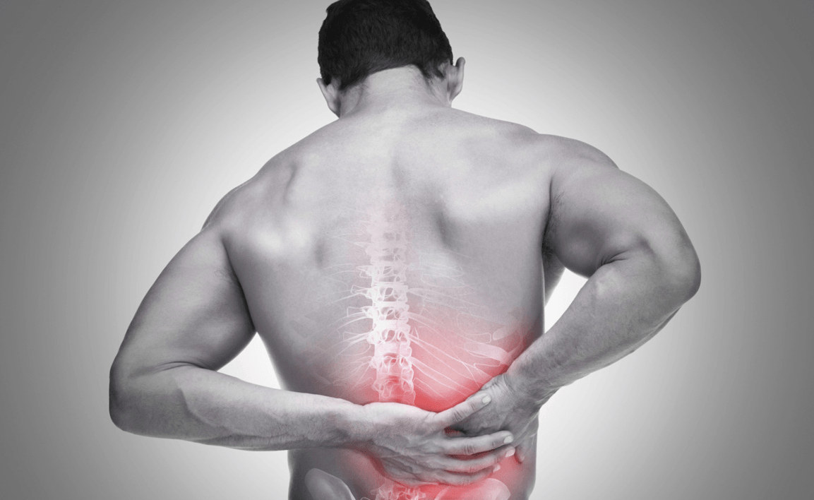 dieu tri hep ong song that lung - Điều trị hẹp ống sống thắt lưng