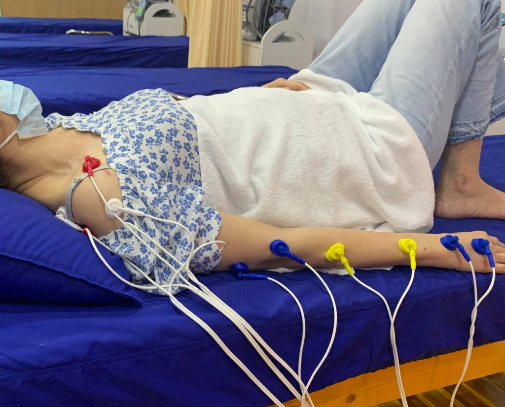 điều trị hội chứng ống khuỷu tay