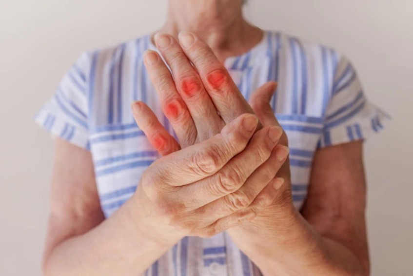 dau khop ngon tay - Đau khớp ng&oacute;n tay: Những nguy&ecirc;n nh&acirc;n phổ biến v&agrave; c&aacute;ch điều trị