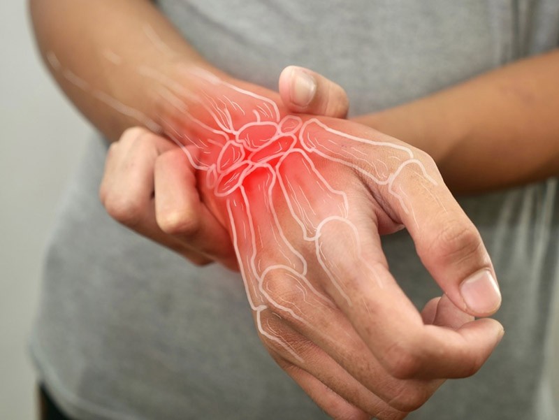 Viêm cơ tay là bệnh gì? Điều trị viêm cơ tay nhanh khỏi Viêm cơ tay là bệnh gì? Điều trị viêm cơ tay nhanh khỏi