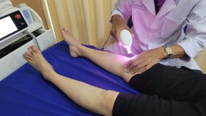 laser trị liệu bhyt laser trị liệu bhyt