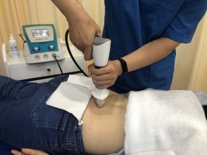 Điều Trị Viêm Gân Bằng Sóng Xung Kích Điều Trị Viêm Gân Bằng Sóng Xung Kích