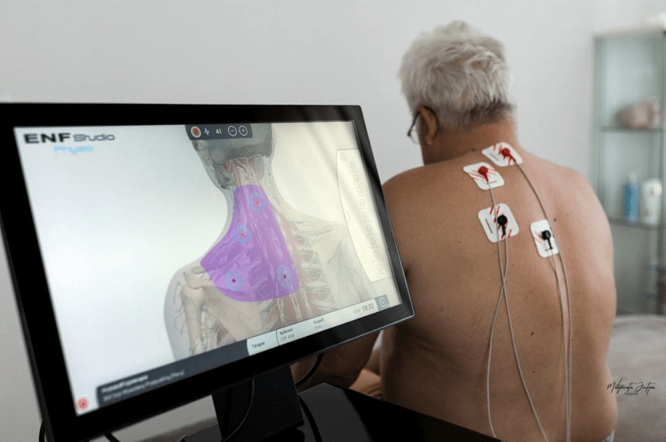 emg biofeedback la gi 3 - EMG Biofeedback l&agrave; g&igrave;? Cơ chế, chỉ định v&agrave; bảng gi&aacute; thiết bị mới nhất