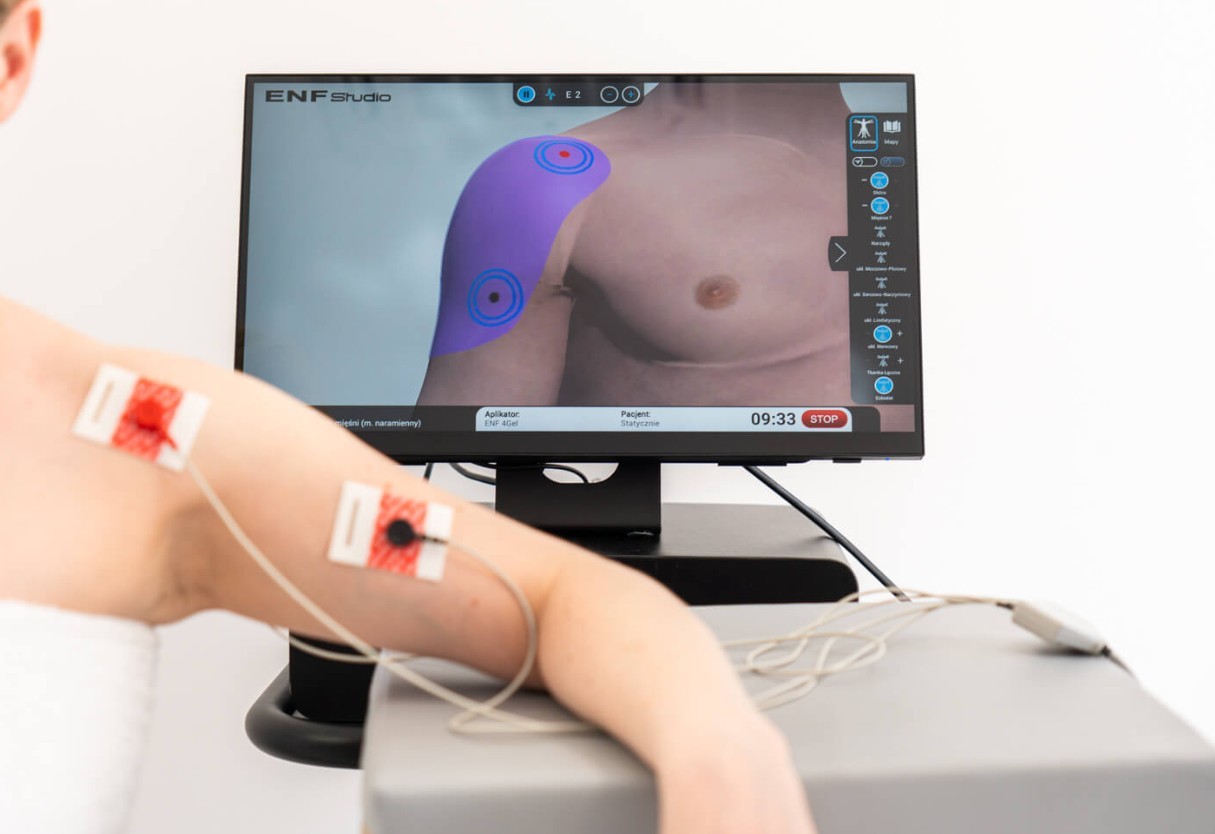 emg biofeedback la gi - EMG Biofeedback l&agrave; g&igrave;? Cơ chế, chỉ định v&agrave; bảng gi&aacute; thiết bị mới nhất